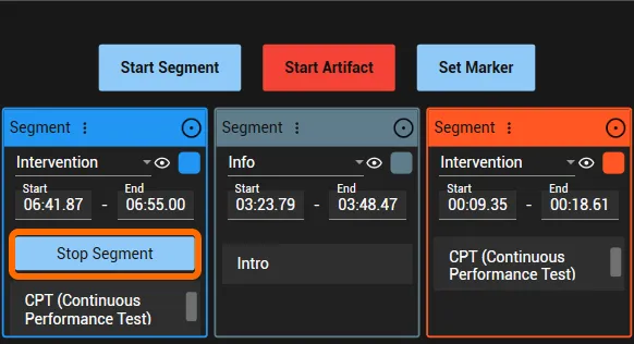 Stop Segment button