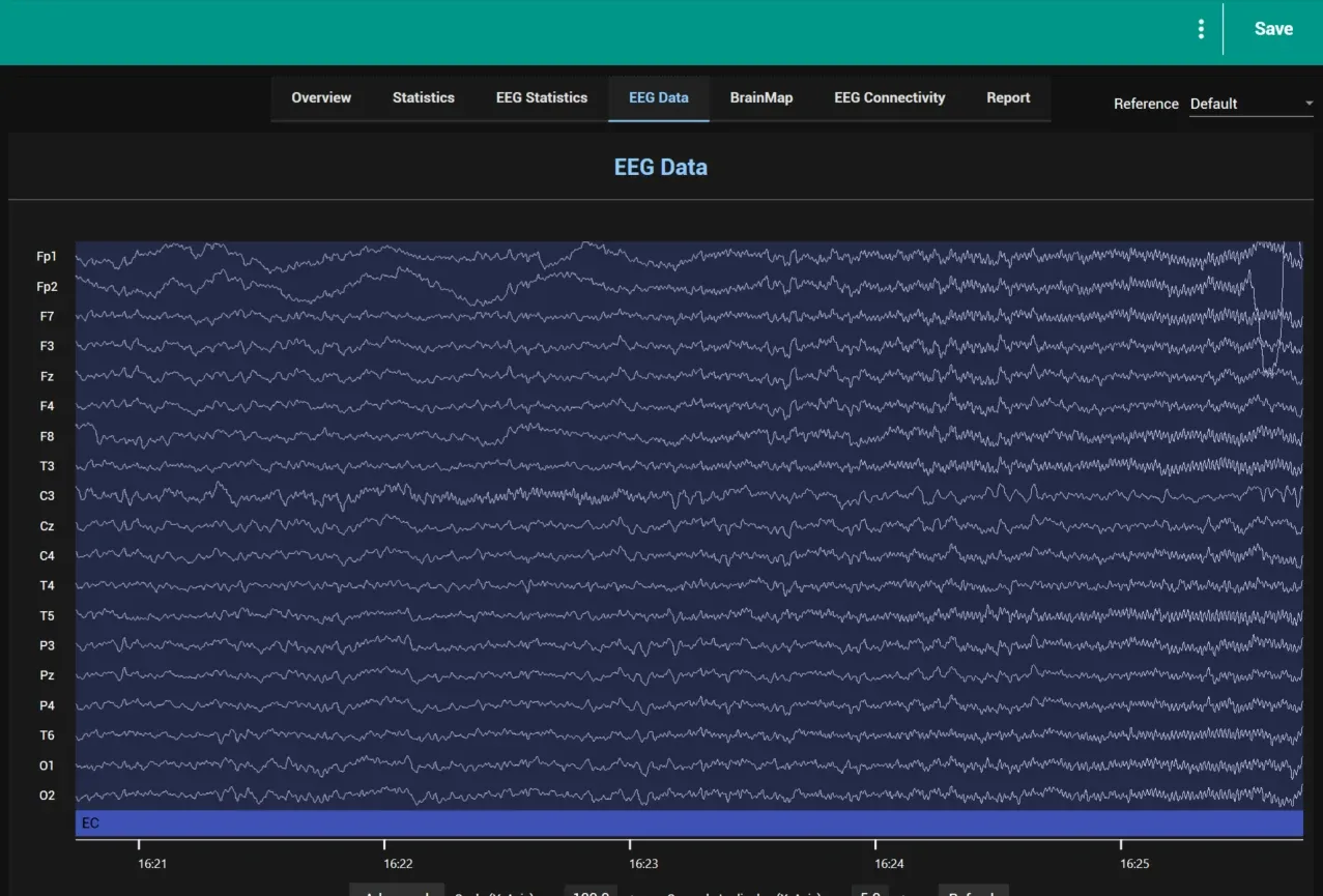 EEG Data page with the segments