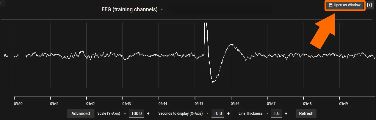 Symbol to open the raw EEG in a separate window