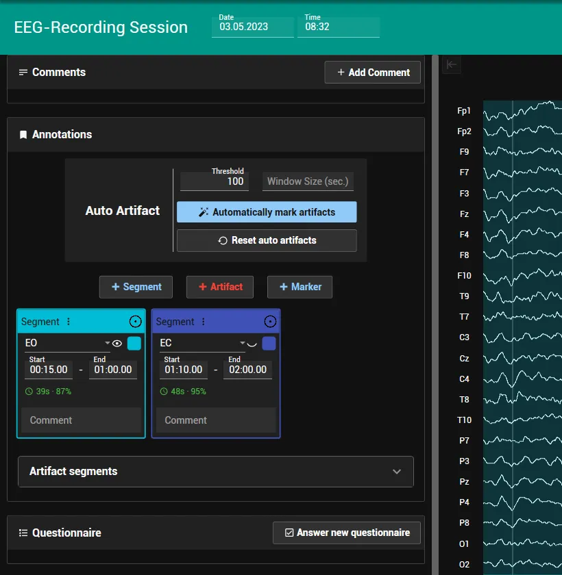 qEEG session with the 10-20 channels and EO and EC segments