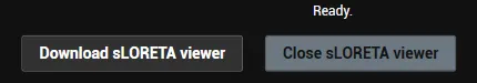 First use: download the sLORETA viewer
